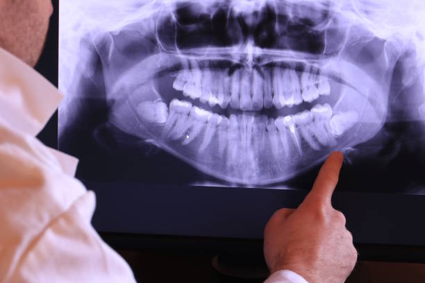 Best Emergency Treatment for Dental Infections or Abscesses in Sunnyside Tahoe City, CA