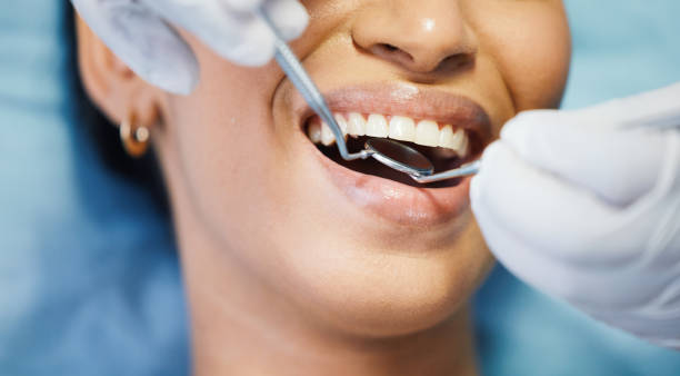 Best Emergency Dental Care for Broken or Chipped Teeth in Sunnyside Tahoe City, CA